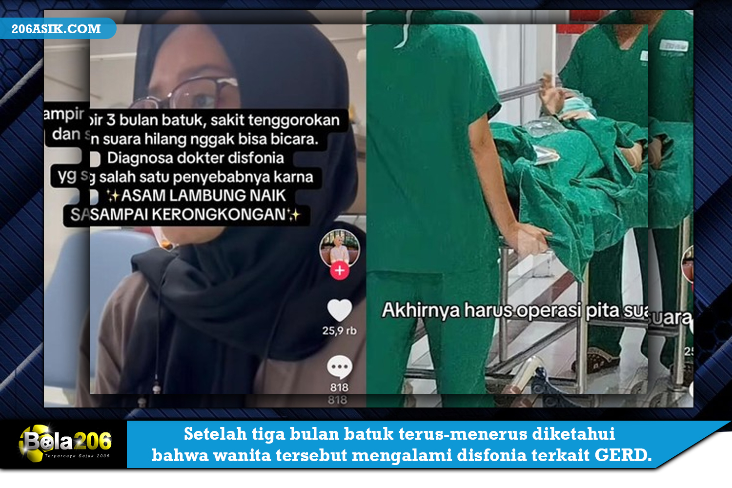 Setelah tiga bulan batuk terus-menerus hingga harus dioperasi, diketahui bahwa wanita tersebut mengalami disfonia terkait GERD.